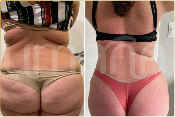 result lipo h (2)